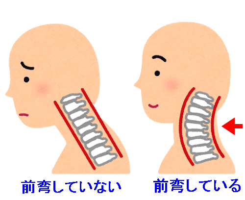sick_straight_neck01